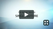 The Beeley Trocar - Single Suture